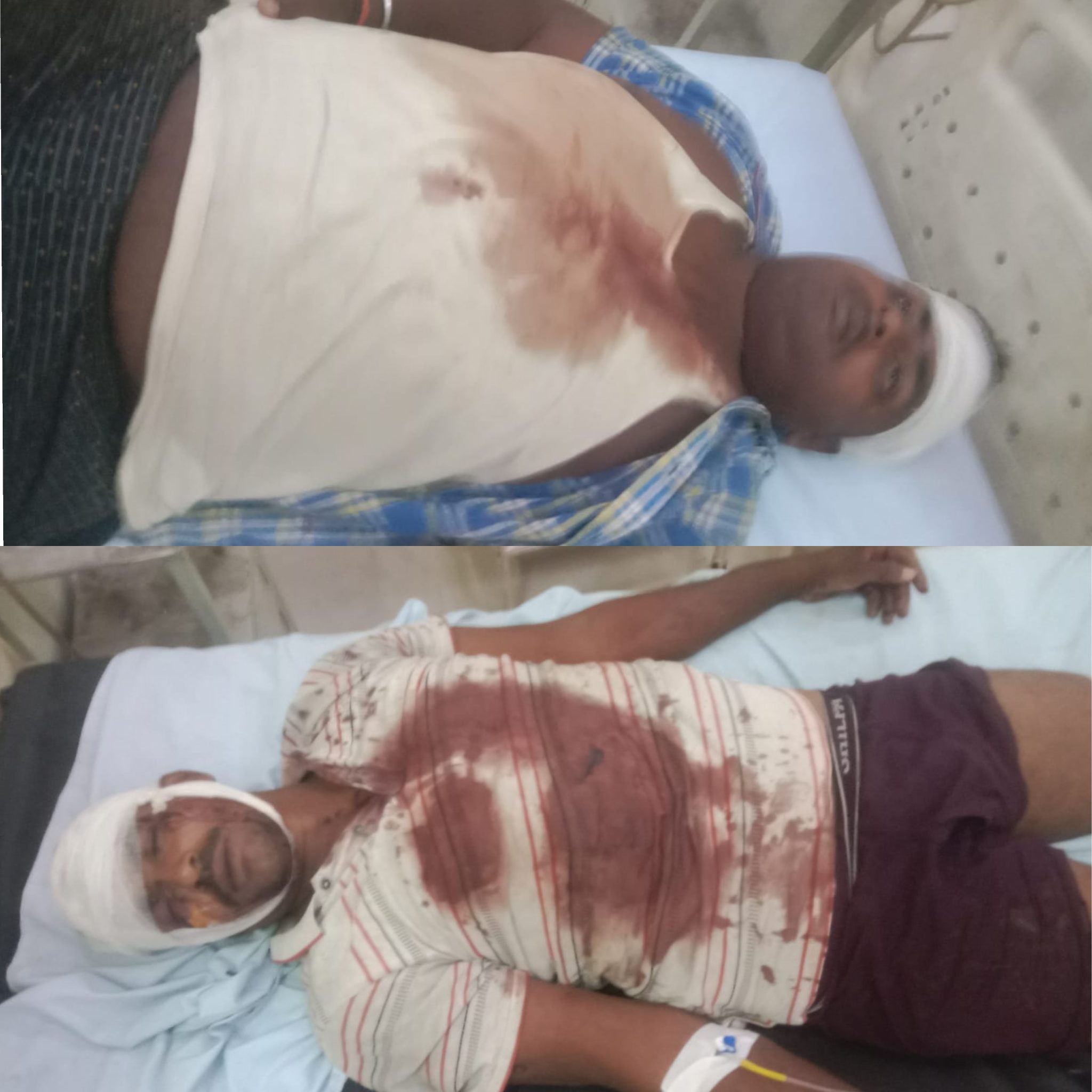 चुनावी रंजिश के चलते मार पीट व कुल्हाड़ी से हमला, एसपी की चौखट पर पहुंचा पीड़ित परिवार